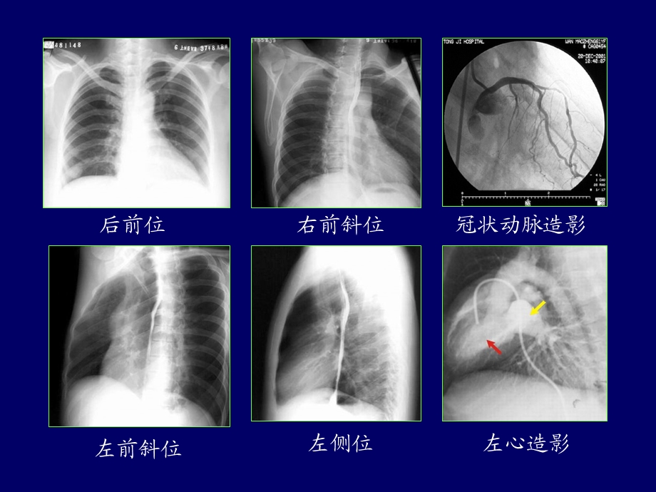 循环系统影像诊断(教学ppt课件).ppt_第3页