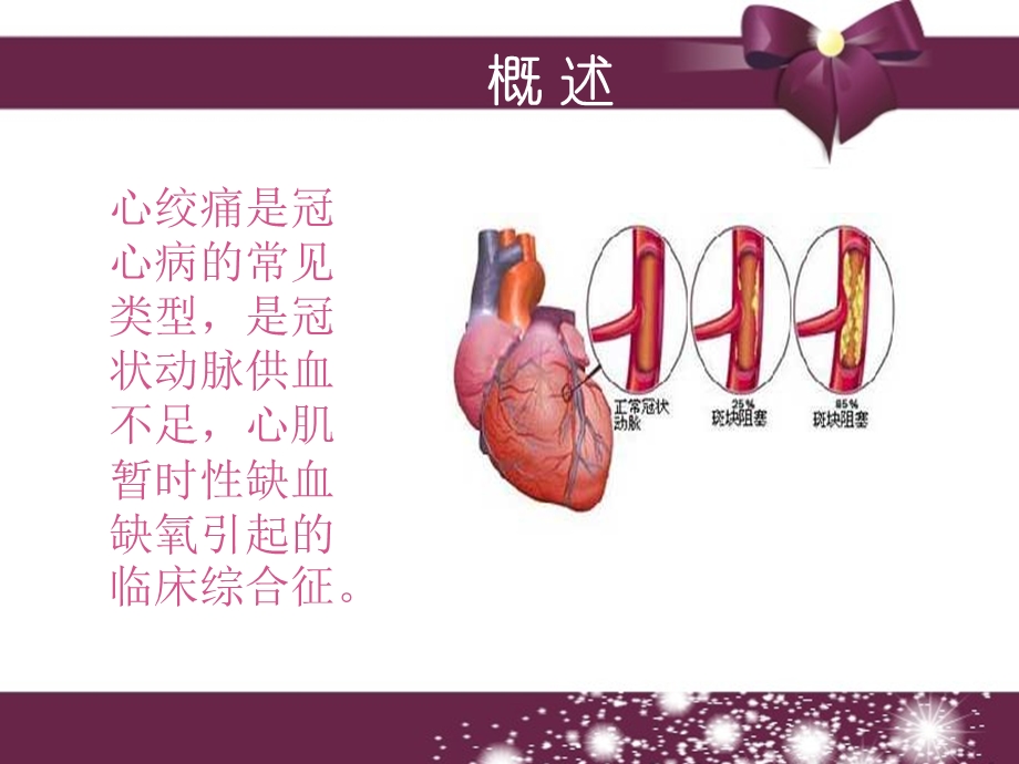 心绞痛患者的健康教育ppt课件.ppt_第2页