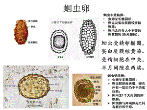 寄生虫学虫卵经典总结及图片 (yj)ppt课件.ppt