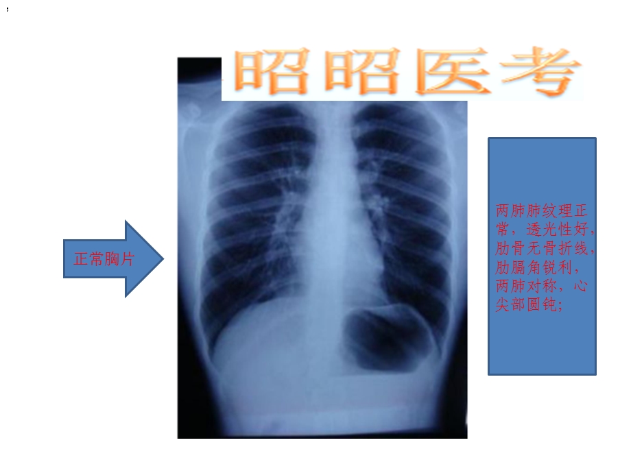 昭昭医考影像学考试图ppt课件.pptx_第2页