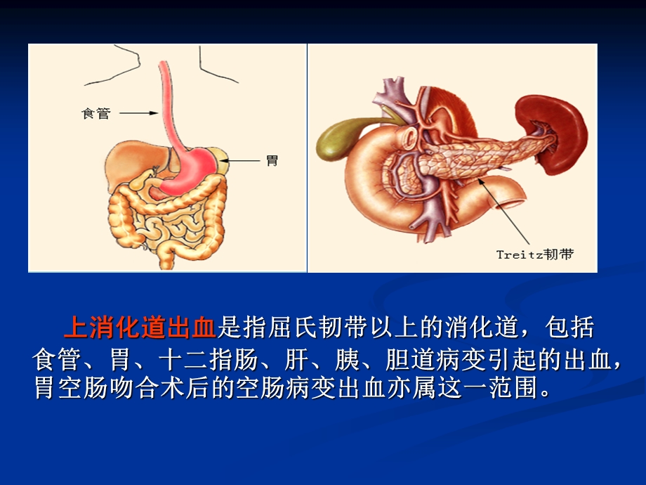 消化道出血护理查房(带病例)ppt课件.ppt_第3页