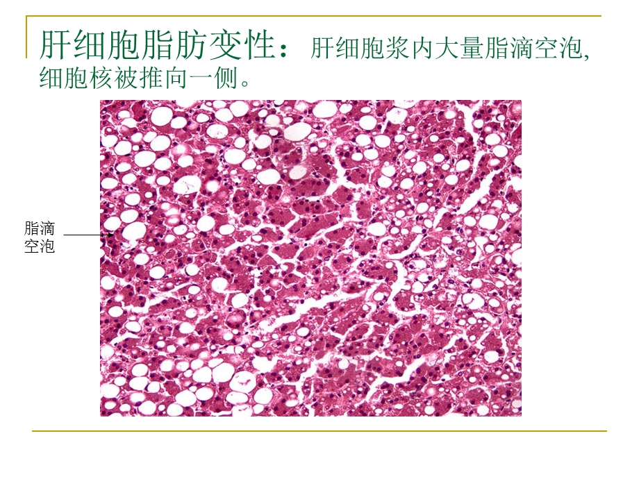 病理学实验切片考试图ppt课件.ppt_第2页