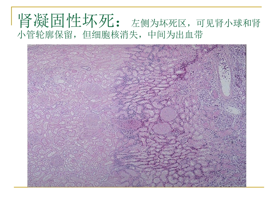 病理学实验切片考试图ppt课件.ppt_第3页