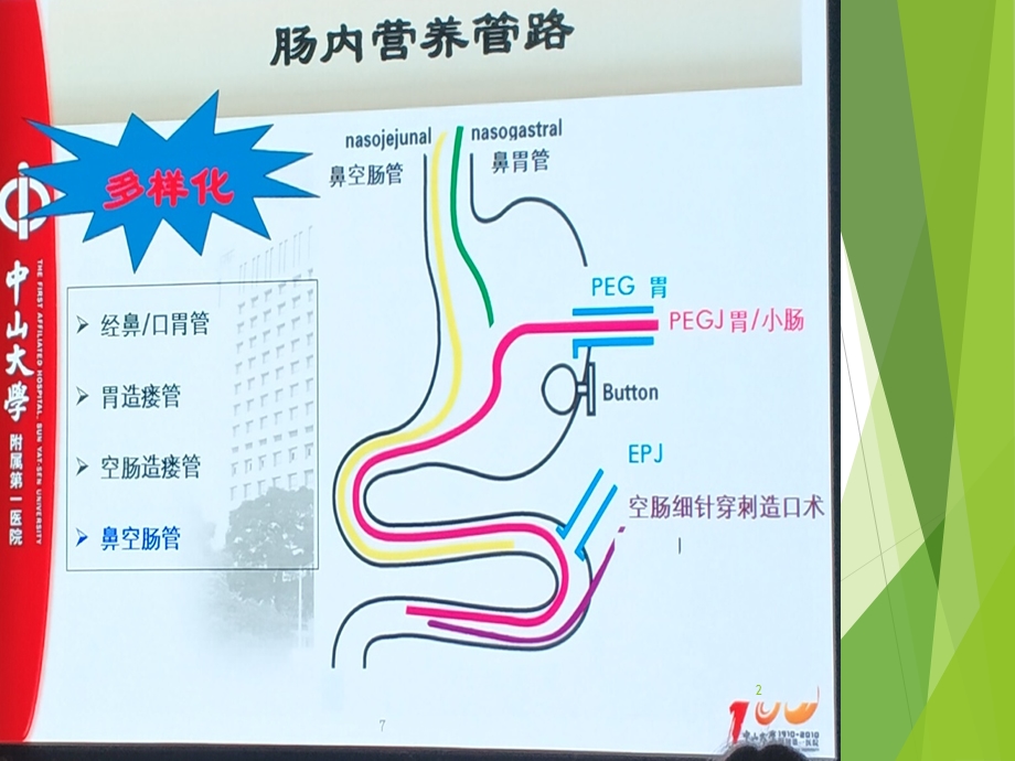 空肠营养管的护理ppt课件.ppt_第2页