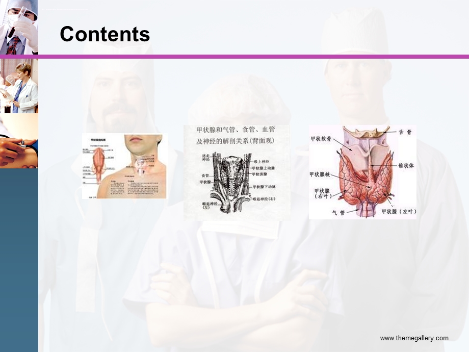 甲状腺肿瘤护理ppt课件.ppt_第3页