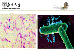 炭疽芽孢杆菌ppt课件.ppt