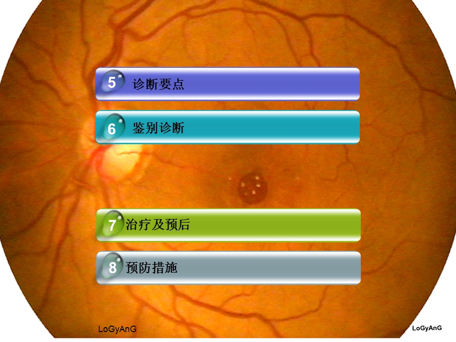 眼底病黄斑裂孔ppt课件.ppt_第3页