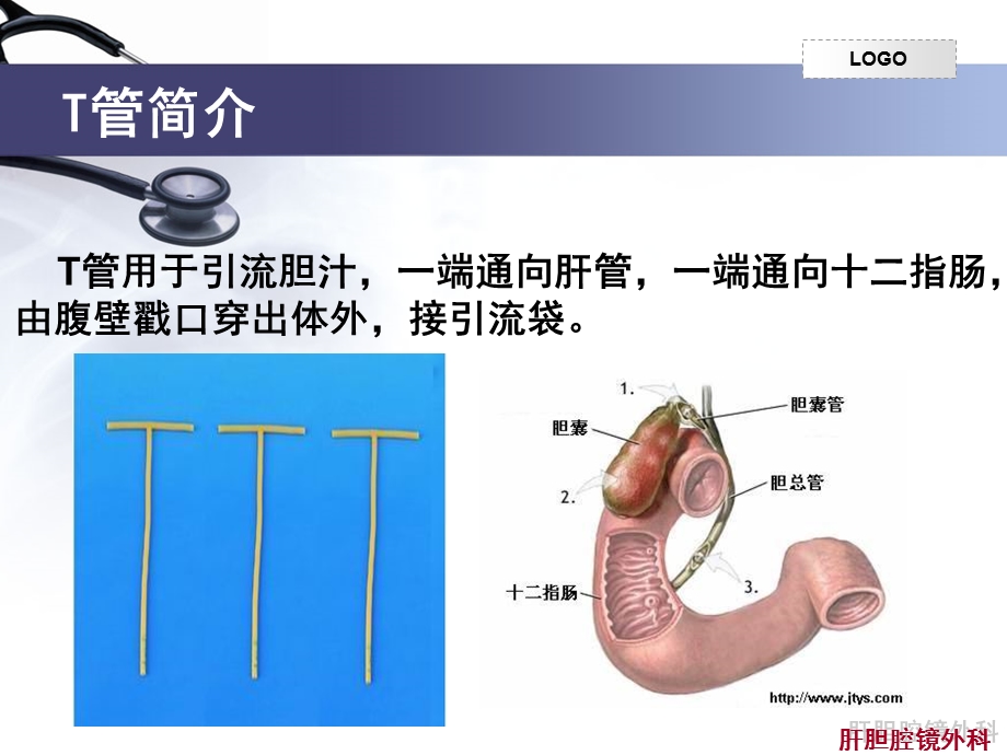 留置T管的护理ppt课件.ppt_第3页