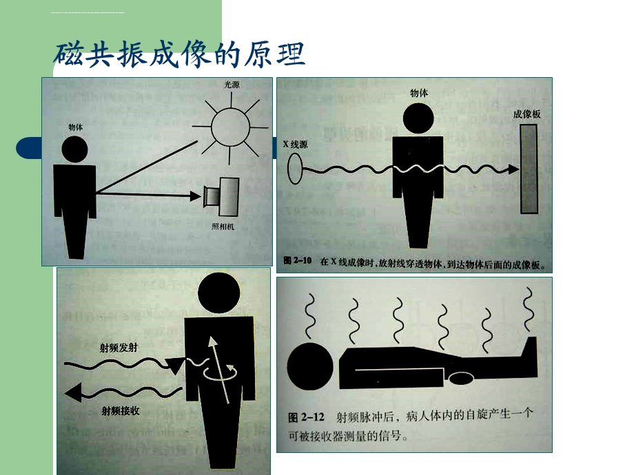 磁共振的临床应用ppt课件.ppt_第3页