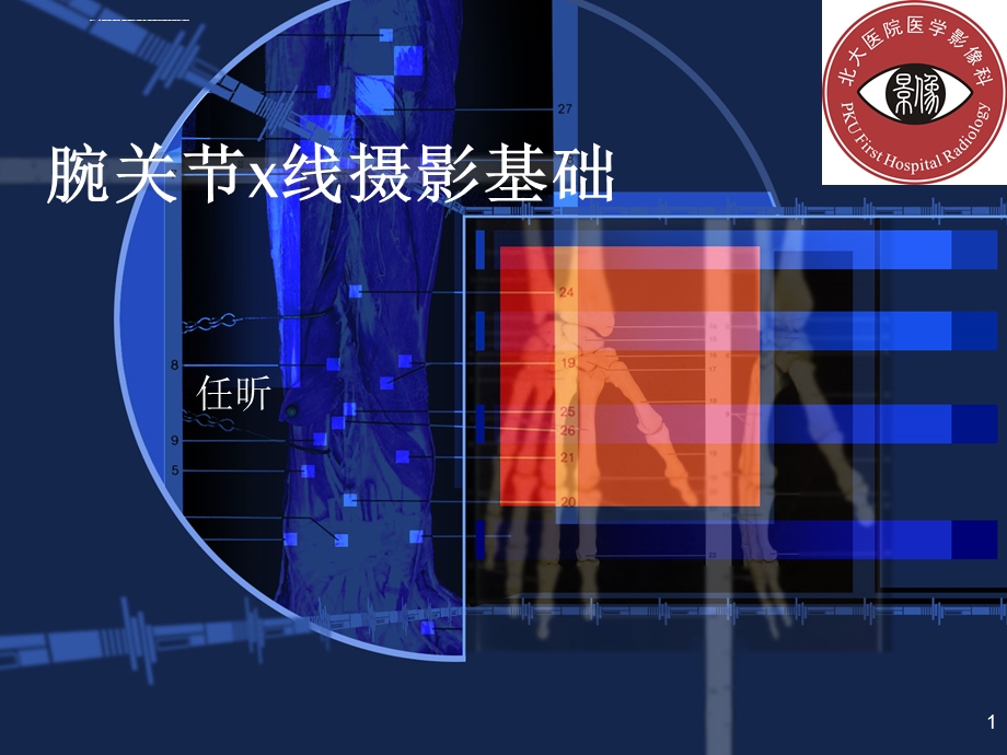 腕关节常见骨折与摄影方法ppt课件.ppt_第1页