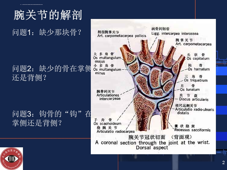 腕关节常见骨折与摄影方法ppt课件.ppt_第2页