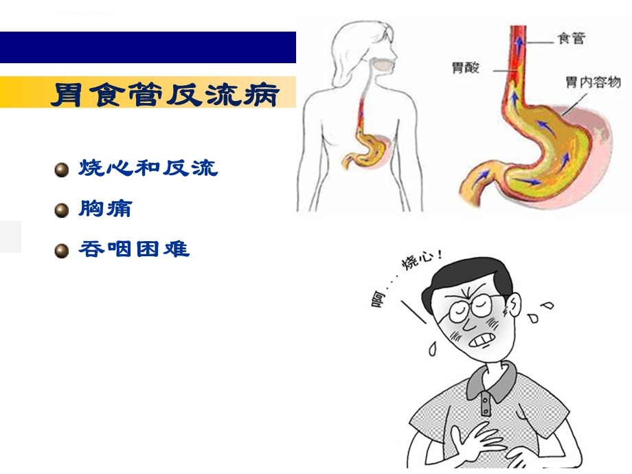 胃炎ppt课件精华版.ppt_第3页