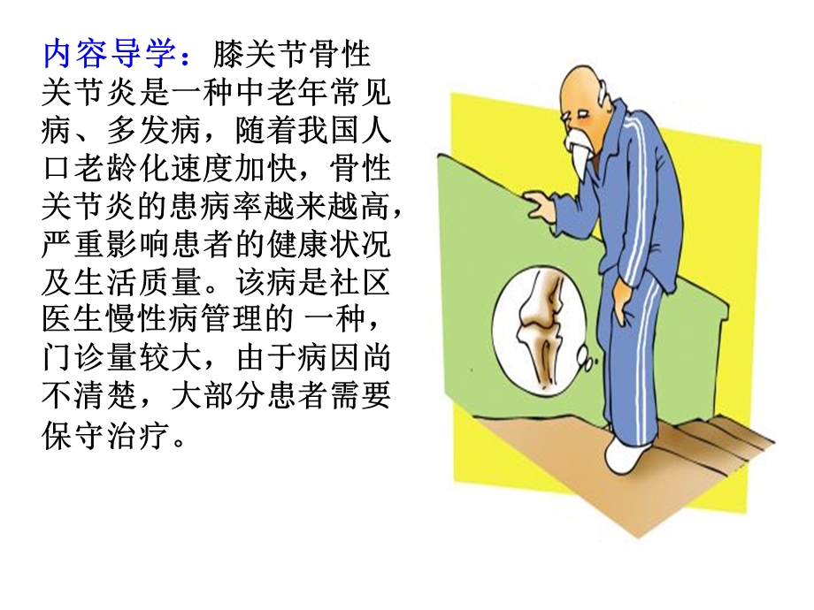 膝关节骨性关节炎ppt课件.ppt_第2页