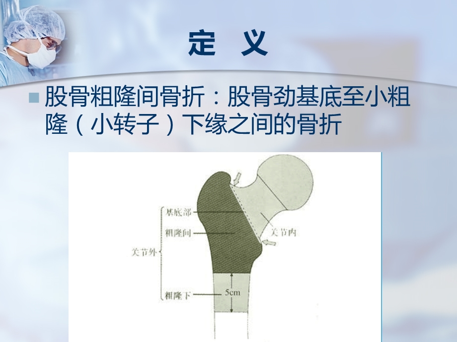 股骨粗隆间骨折 PPT课件.ppt_第2页