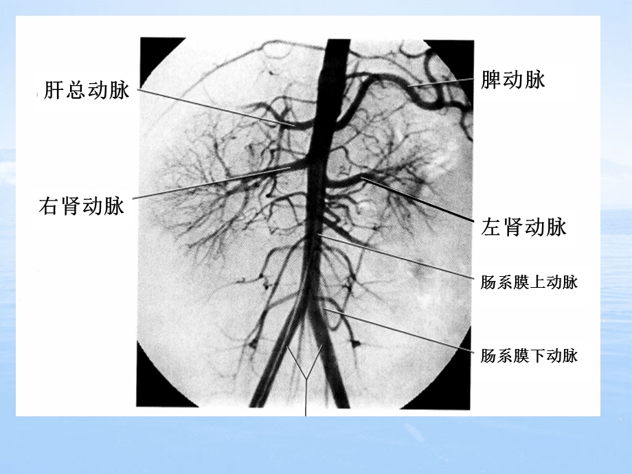 腹部的血管解剖ppt课件.ppt_第3页