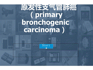 肺癌精品ppt课件.ppt