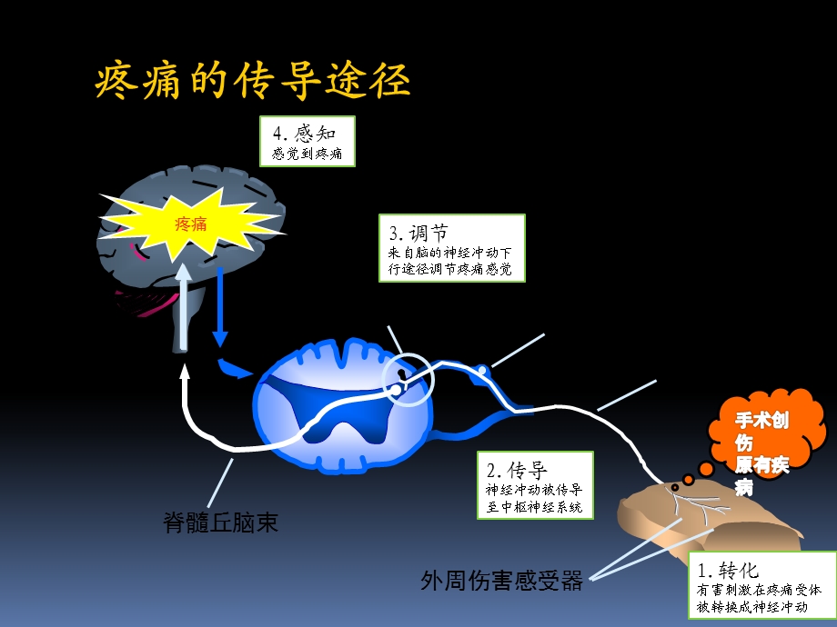 疼痛科科普ppt课件.pptx_第3页