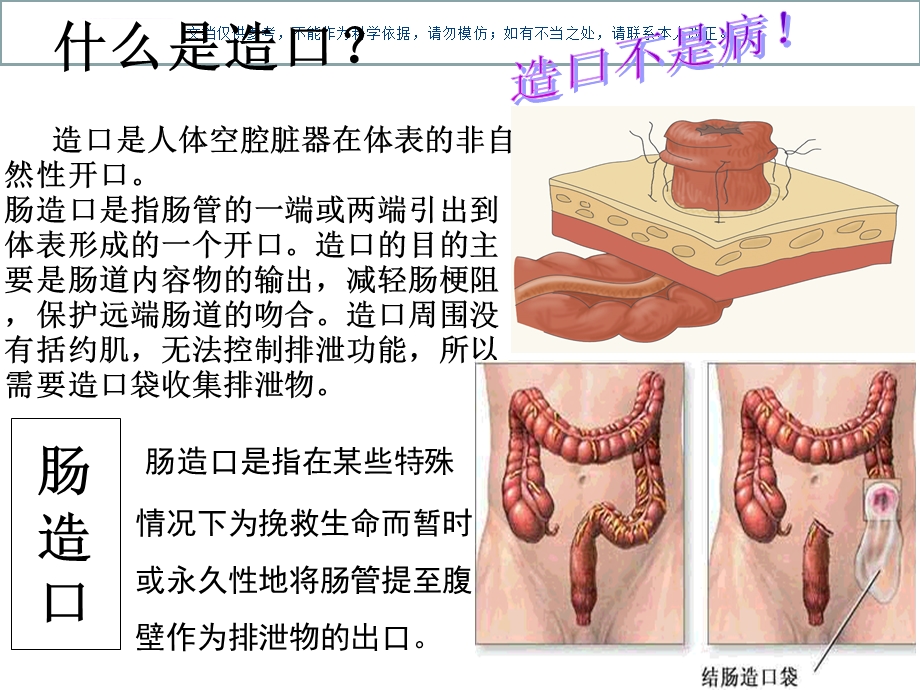 肠造口手册于艳ppt课件.ppt_第3页