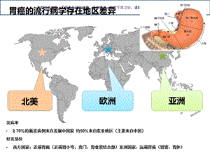 胃癌诊治策略ppt课件.ppt