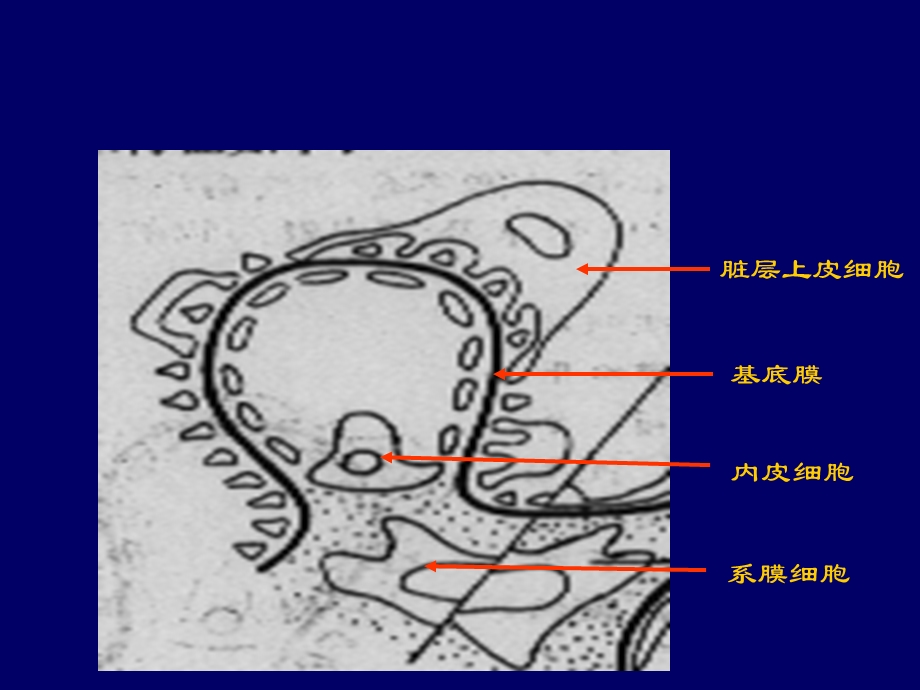 肾病综合征病理图片ppt课件.ppt_第3页