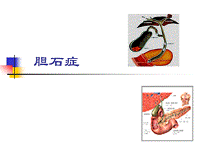 胆石症ppt课件.ppt