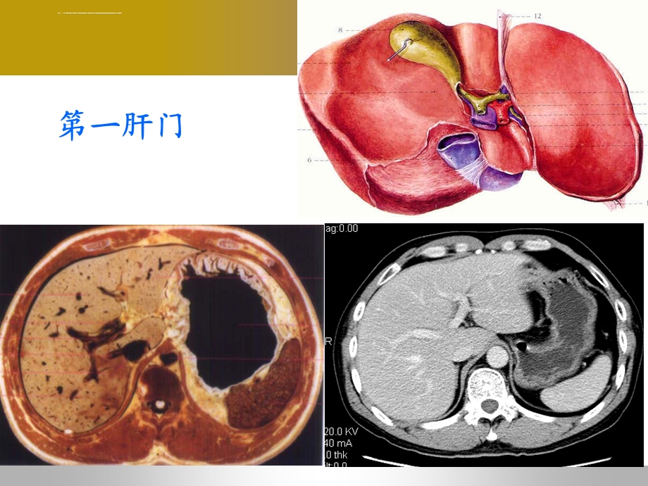 肝脏血管系统疾病影像诊断ppt课件.ppt_第3页