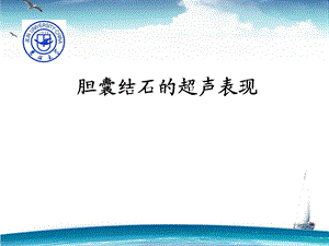 胆囊结石的超声表现ppt课件.ppt