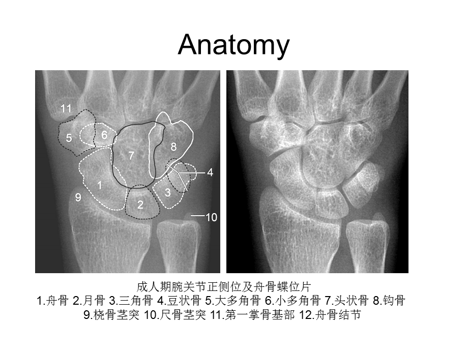 腕关节 X线解剖ppt课件.ppt_第2页