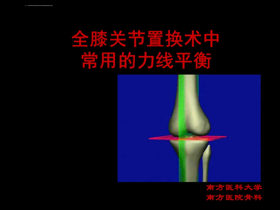 膝关节置换TKA的截骨力线ppt课件.ppt_第1页