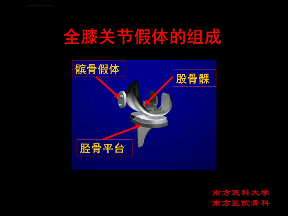 膝关节置换TKA的截骨力线ppt课件.ppt_第3页