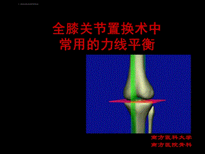 膝关节置换TKA的截骨力线ppt课件.ppt