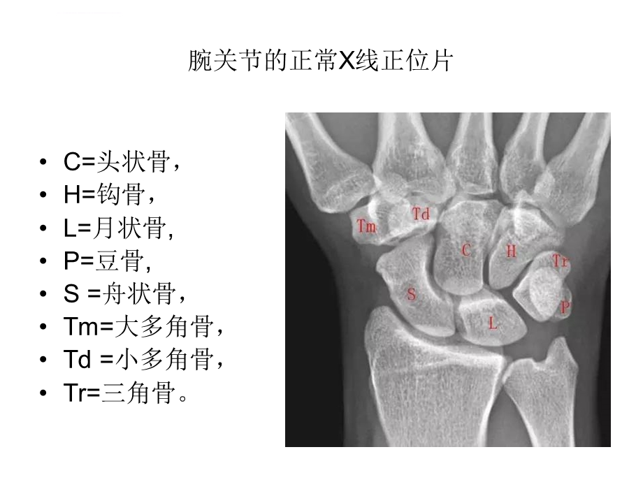 腕关节大全ppt课件.ppt_第3页