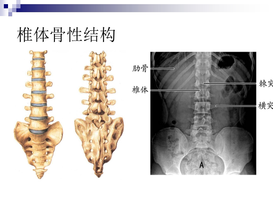 腰椎血管神经解剖ppt课件.ppt_第2页