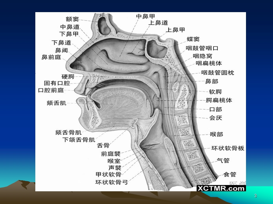 耳鼻喉常见病培训ppt课件.ppt_第3页