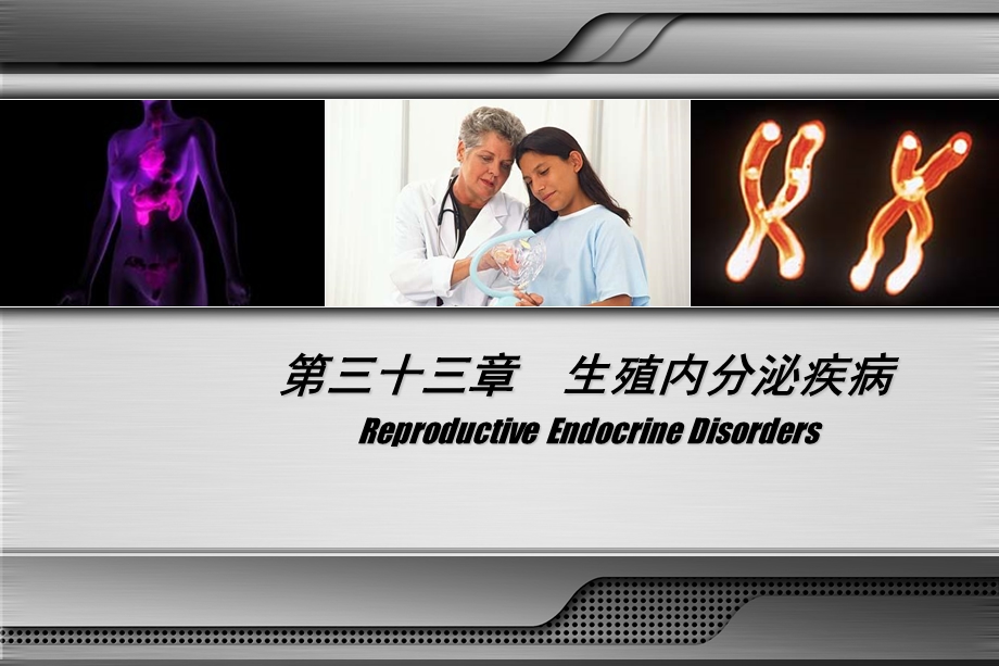 第八版妇产科学配套ppt课件闭经.ppt_第3页