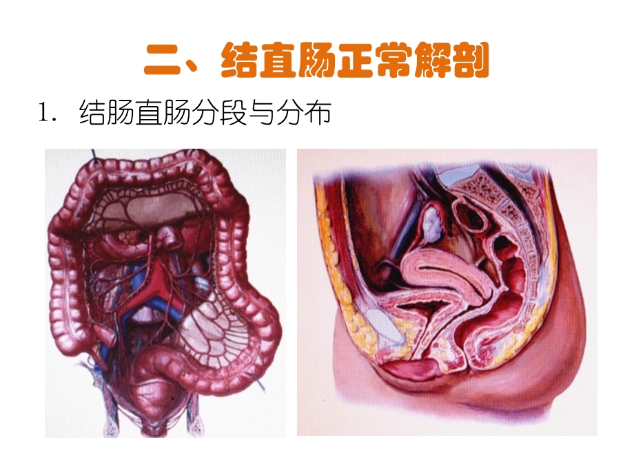 结肠狭窄支架置入术ppt课件.pptx_第3页