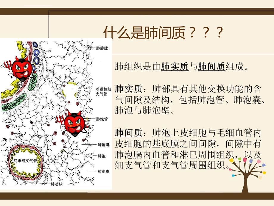 间质性肺炎护理查房ppt课件.ppt_第3页