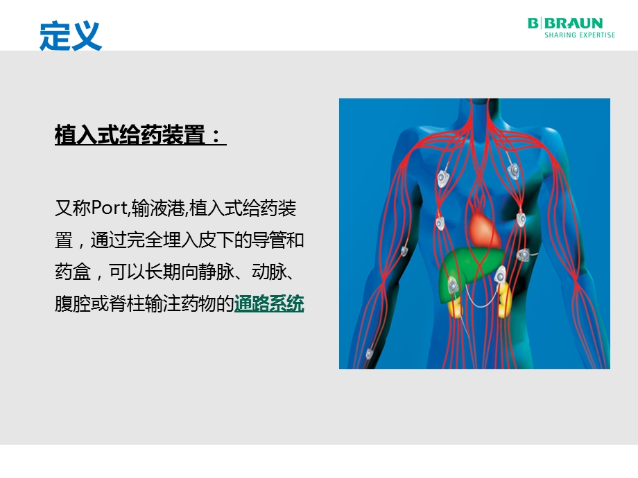 输液港术后维护及并发症处理ppt课件.pptx_第3页