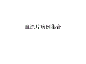 血涂片病例集合ppt课件.pptx