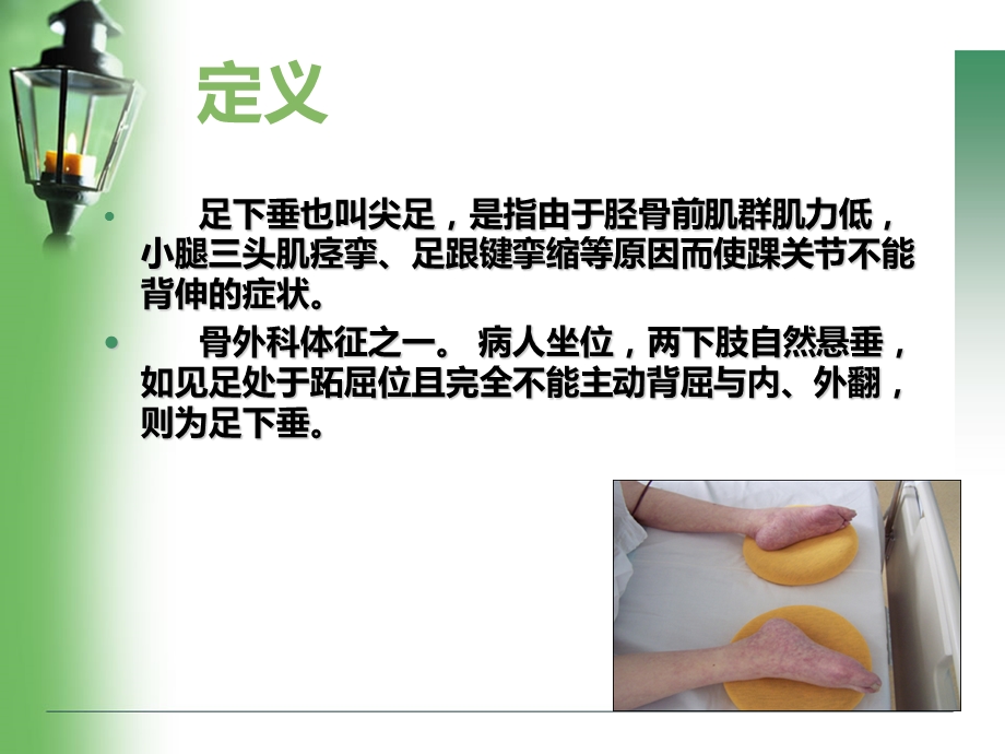 足下垂的防治与护理ppt课件.ppt_第3页