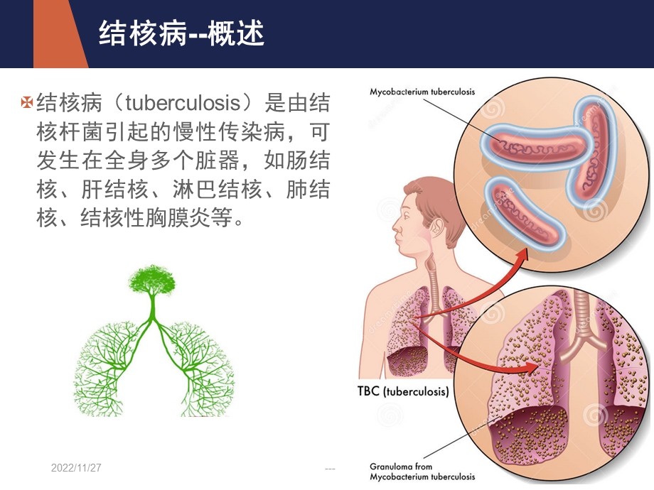 结核病营养治疗课件.ppt_第2页