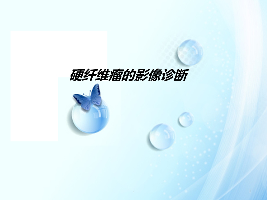 硬纤维瘤的影像诊断课件.ppt_第1页