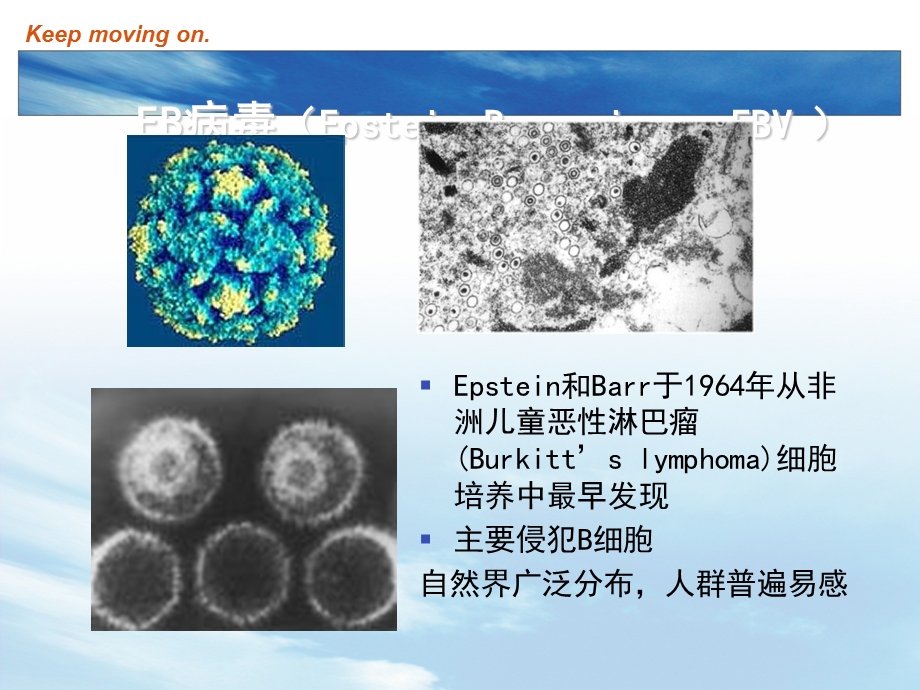 EB病毒感染和传染性单核细胞增多症主题讲座ppt课件.ppt_第2页