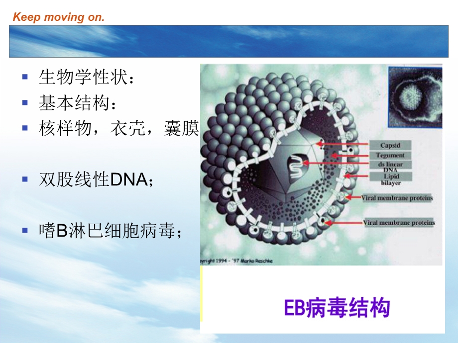 EB病毒感染和传染性单核细胞增多症主题讲座ppt课件.ppt_第3页