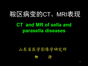 鞍区解剖 断层影像解剖ppt课件.ppt