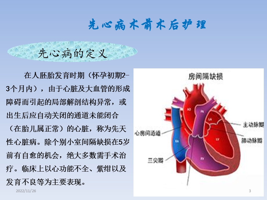 先心病课件.pptx_第3页