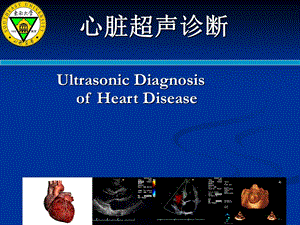 心脏超声诊断解剖及正常断面课件.ppt