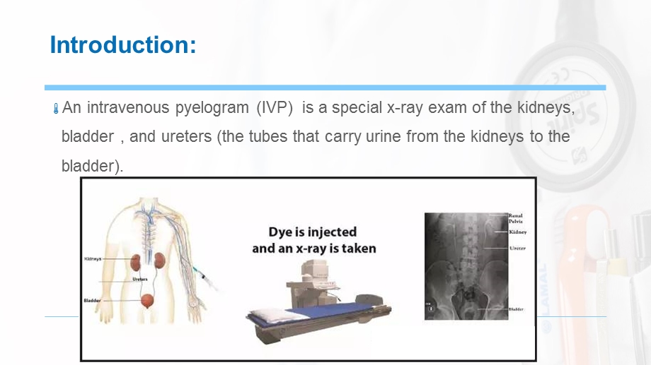 静脉肾盂造影(IVP)ppt课件.pptx_第2页