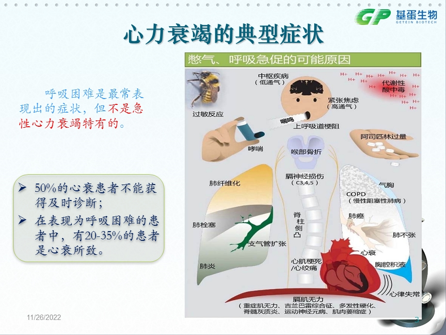 心肌标志物的临床应用课件.ppt_第3页