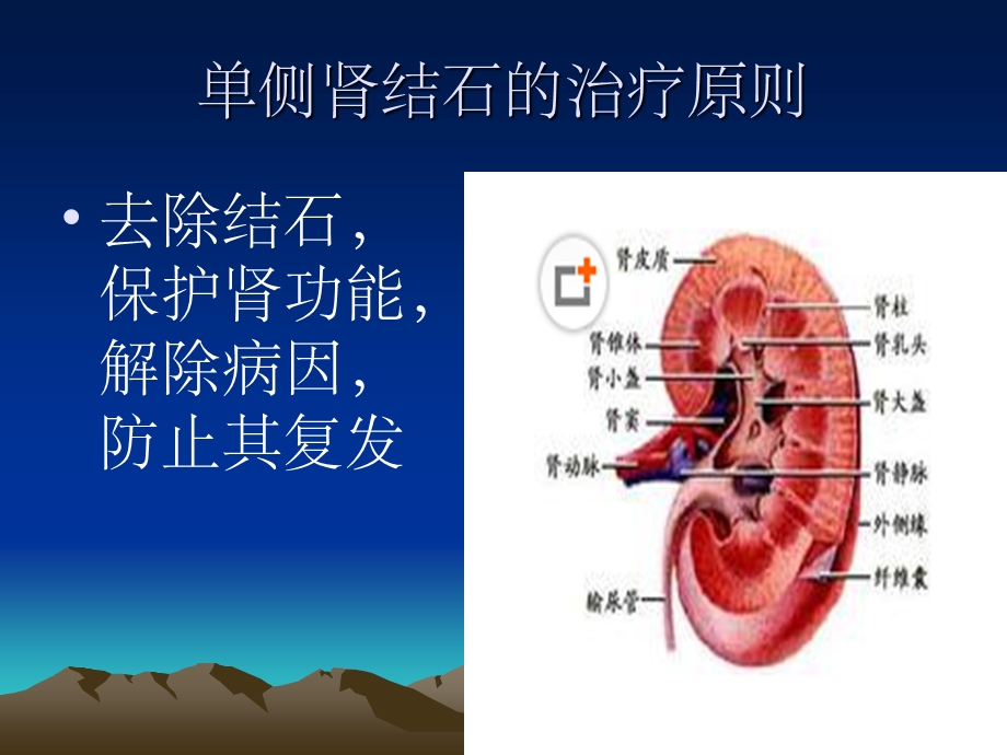 泌尿系结石的治疗课件.ppt_第3页